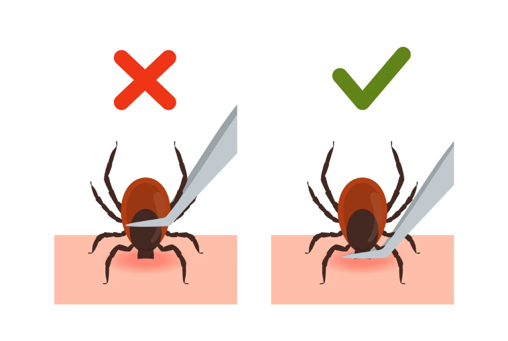 how to properly remove a tick